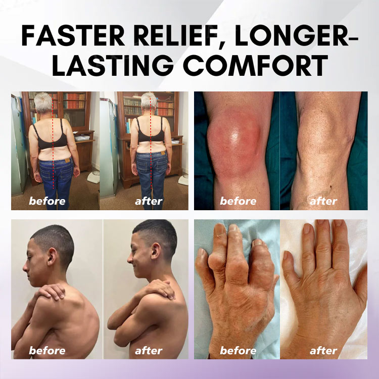 ⏰Last Day Promotion: BUY 1 GET 1 FREE🔥Lovilds™ Turmeric & Emu Oil Arthritis Soothing Pain Relief Massage Gel 👨‍⚕️Australian Osteopathic Association （AOA）Approved