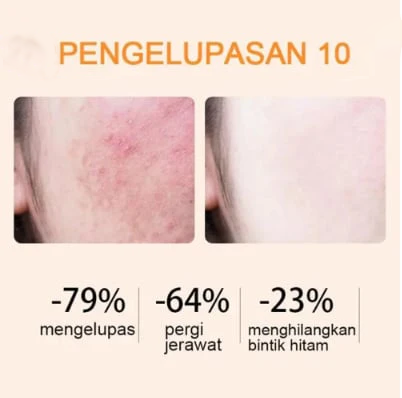 🔥Orange Enzyme Exfoliating Gel — The Gentle Miracle Your Skin Has Been Crying Out For