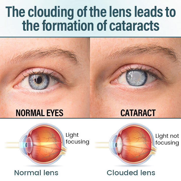 LOVILDS® OptiFusion Nano Eye Drops Serum 19