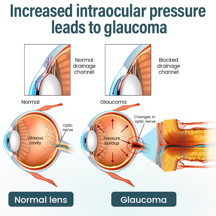 LOVILDS® OptiFusion Nano Eye Drops Serum 19