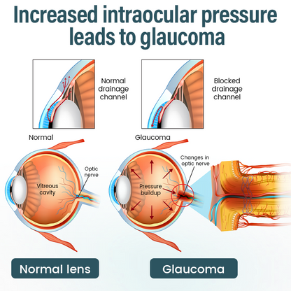 LOVILDS® OptiFusion Nano Eye Drops Serum 19