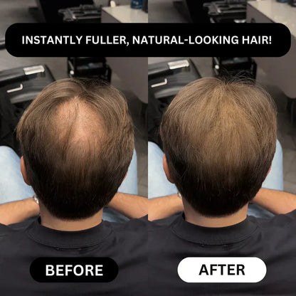 🔥Limited-Time Holiday Offer-Thicker-Looking Hair in 30 Seconds. Confidence All Day.